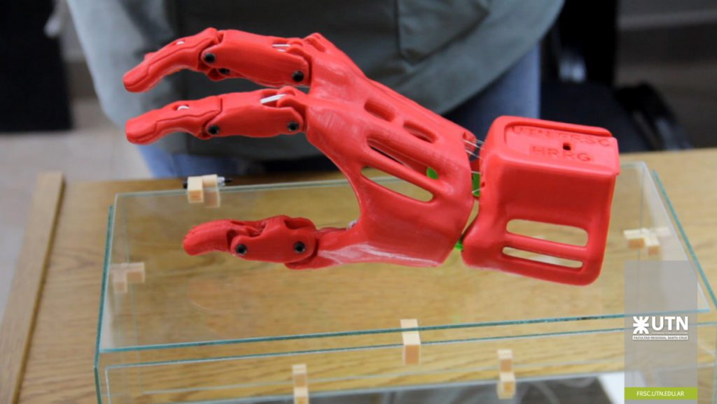 La primeras prótesis 3D de la Regional Santa Cruz ya son una realidad