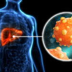 Tierra del Fuego reforzó la prevención de hepatitis con una campaña integral en toda la provincia